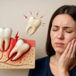 Wisdom Tooth Pain: Common Causes and How to Find Relief